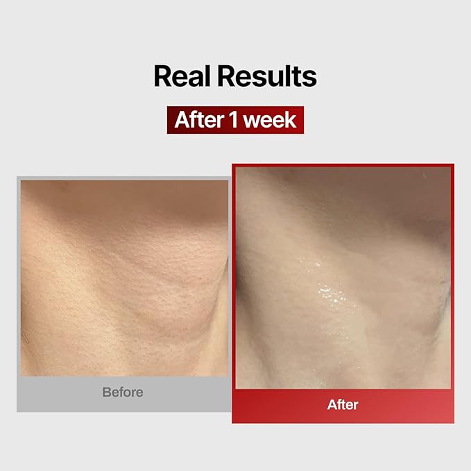 MEDITHERAPY Wrinkle-fit Face Mask & Wrinkle-fit Neck Mask + Facial Roller - Neck Wrinkle Patches, Neck Firming and Tightening Korean Deep Collagen Mask - Mesh Sheet Mask for Lifting Sagging Skin