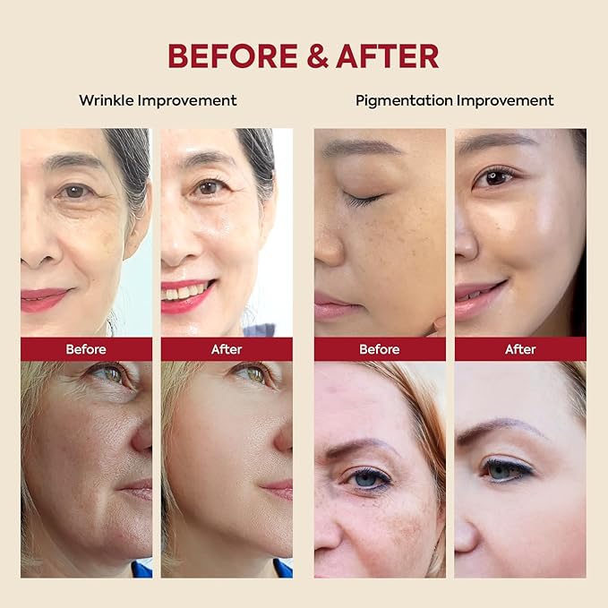 K-SECRET SEOUL 1988 Retinal Serum: Retinol Serum for Face Anti Aging Wrinkle Care - 2% Retinal Liposome Black Ginseng Niacinamide Bakuchiol Vitamin C & 3 Peptides - Korean Skincare Fragrance Free 30mL