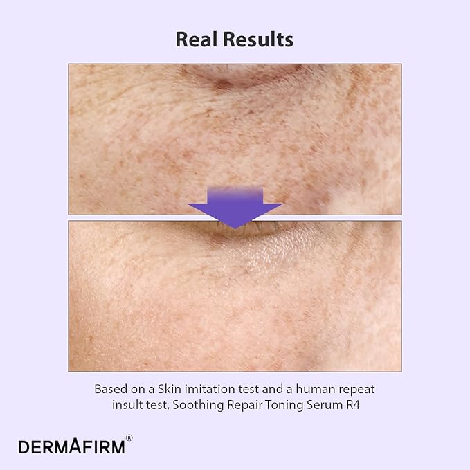DERMAFIRM Korean Bakuchiol Retinol Serum for Wrinkles w/Niacinamide & Peptides | Soothing Repair Toning Serum R4 for Wrinkle | No Animal Trials 1.01 fl oz
