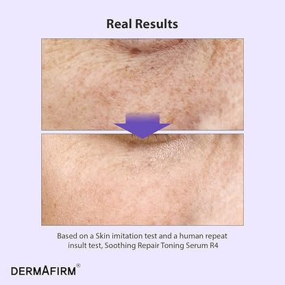 DERMAFIRM Korean Bakuchiol Retinol Serum for Wrinkles w/Niacinamide & Peptides | Soothing Repair Toning Serum R4 for Wrinkle | No Animal Trials 1.01 fl oz
