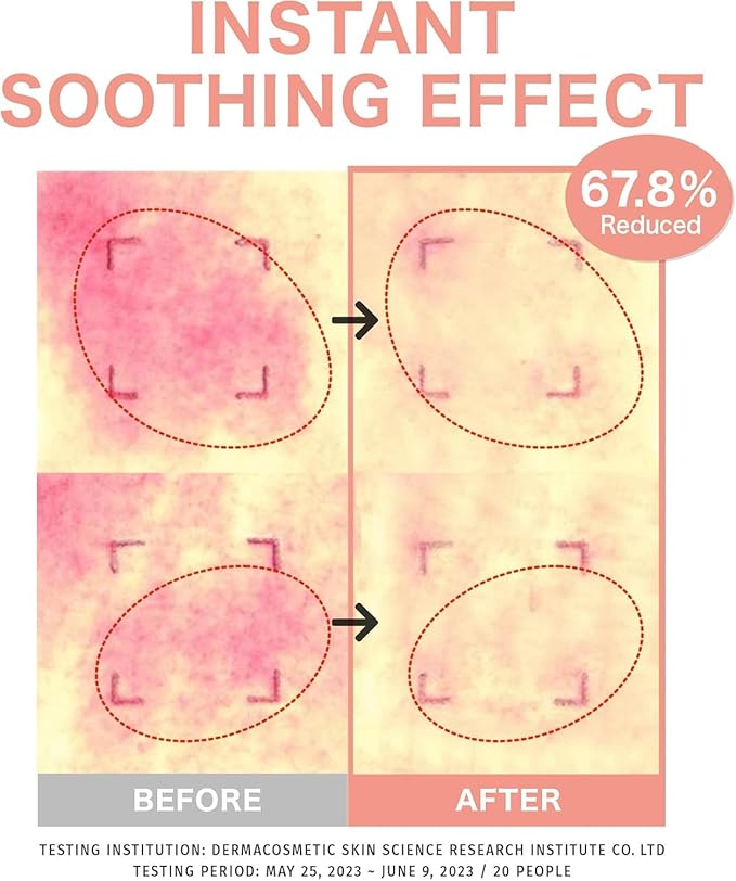 Barrier Enhancing Toner to Essence Bundle (50ml+200ml) | Moisturizing Lotion for Skin Barrier Repair, Glow & Soothing | Vegan Hypoallergenic Glass Skin Korean Skincare | Sensitive & Dry Skin