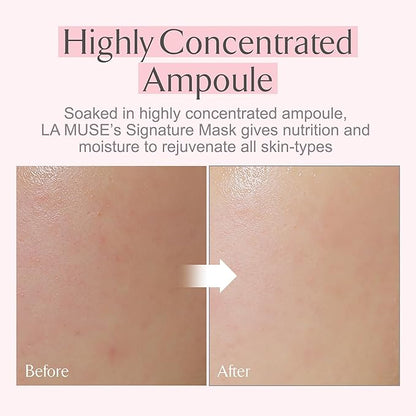 LA MUSE Coconut Gel Mask(Bio-Cellulose) | Intensive Lifting, Firming Care with Peptide for Elasticity | Deep Hydration Korean Face Mask, Instant Revitalizing & Cooling Effect | Korean Skincare, 5-Pack