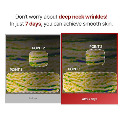 MEDITHERAPY Wrinkle-fit Face Mask & Wrinkle-fit Neck Mask + Facial Roller - Neck Wrinkle Patches, Neck Firming and Tightening Korean Deep Collagen Mask - Mesh Sheet Mask for Lifting Sagging Skin