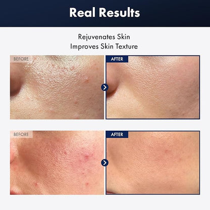 Black Snail Plus Essence With 960,890ppm Black Snail Secretion Filtrate, Hydrating Serum, Repairing, Anti Aging, Dull Skin, Fine Lines, Sensitive Skin, Korean Skin Care, 100ml, 3.38 fl.oz.