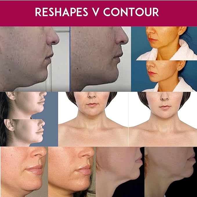 Advanced Neck Cream and Double Mask Works for Neck, Chin, and Jawline - Fine Lines - Neck Wrinkles - Aging for Women and Men. (Cream + Masks)