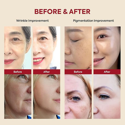 K-SECRET SEOUL 1988 Retinal Serum: Retinol Serum for Face Anti Aging Wrinkle Care - 2% Retinal Liposome Black Ginseng Niacinamide Bakuchiol Vitamin C & 3 Peptides - Korean Skincare Fragrance Free 30mL