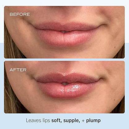 First Aid Beauty Ultra Repair Lip oz