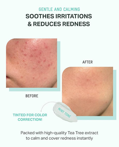 BRING GREEN Tea Tree CICA Mineral Sunscreen SPF 50+ PA++++ | Non-Nano Zinc Oxide Face Sunscreen, Reef Safe Korean Sunscreen for Sensitive Skin, Oil-Free, 1.69 fl. oz