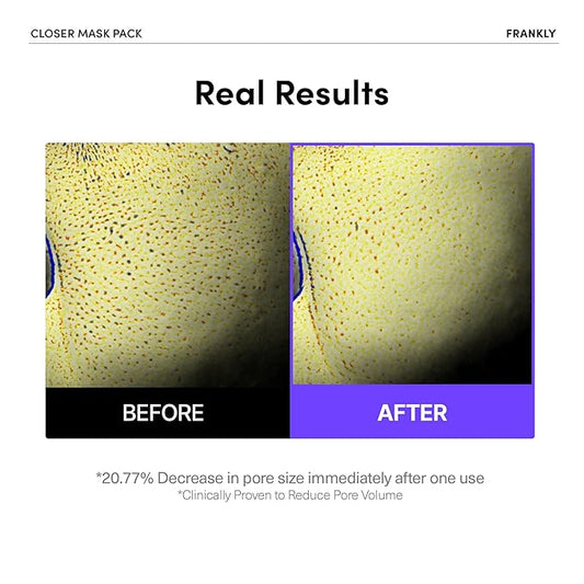FRANKLY Pore Reset Ritual Set – Cleansing Oil, AHA Toner & 10 Semi-Gel Sheet Masks for Smooth, Clear, Poreless Skin