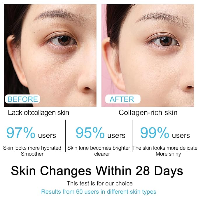 Collagen mask, improves dull skin, restores skin elasticity, 5% Hyaluronic Acid Serum, hydrates and moisturizing, repairs sensitive skin, 2-piece set