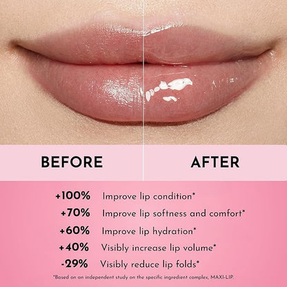 Women's Forget The Filler Lip Plumper Line Gloss, Rosy Outlook, Pink, 0.11 Fl Oz (Pack of 1)