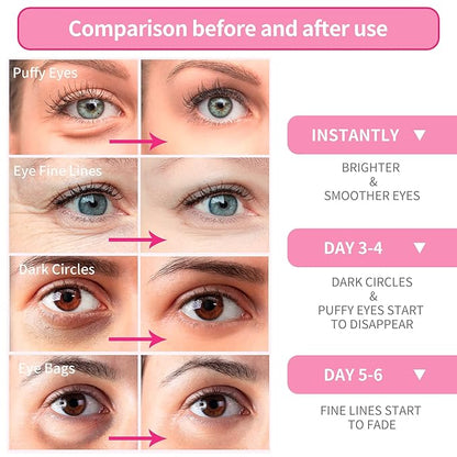 Breylee rose eye mask -