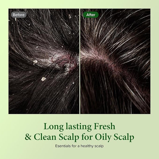 KUNDAL Tea Tree & Macadamia Deep Cleansing Shampoo [Jasmine Woody] - Korean Hair Care, Scalp Care, Tea Tree extract, For All hair Types 10.14fl oz (pack of 1)