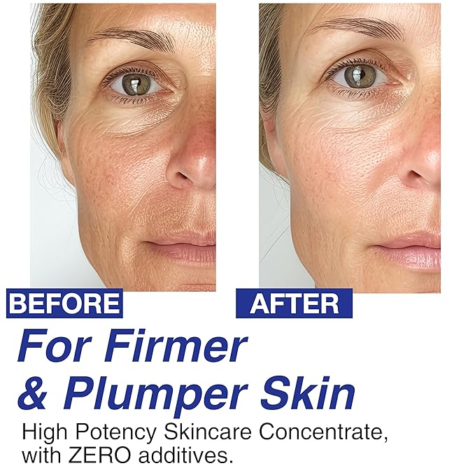 100% Pure Volufiline Concentrate Serum 2ea - Skin Firming Solution & Clinically Proven | Anti-Wrinkle, Enhances Facial Contours, Boosts Collagen for Sagging Mature Skin Korean Skincare