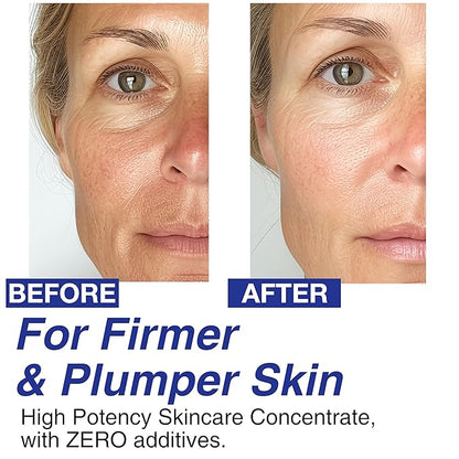 100% Pure Volufiline Concentrate Serum 2ea - Skin Firming Solution & Clinically Proven | Anti-Wrinkle, Enhances Facial Contours, Boosts Collagen for Sagging Mature Skin Korean Skincare